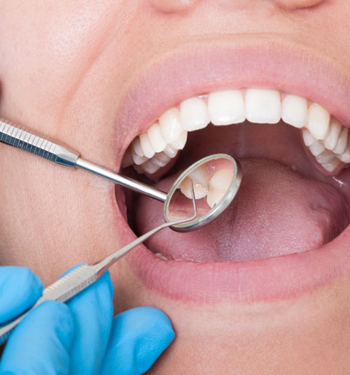 Dental examining