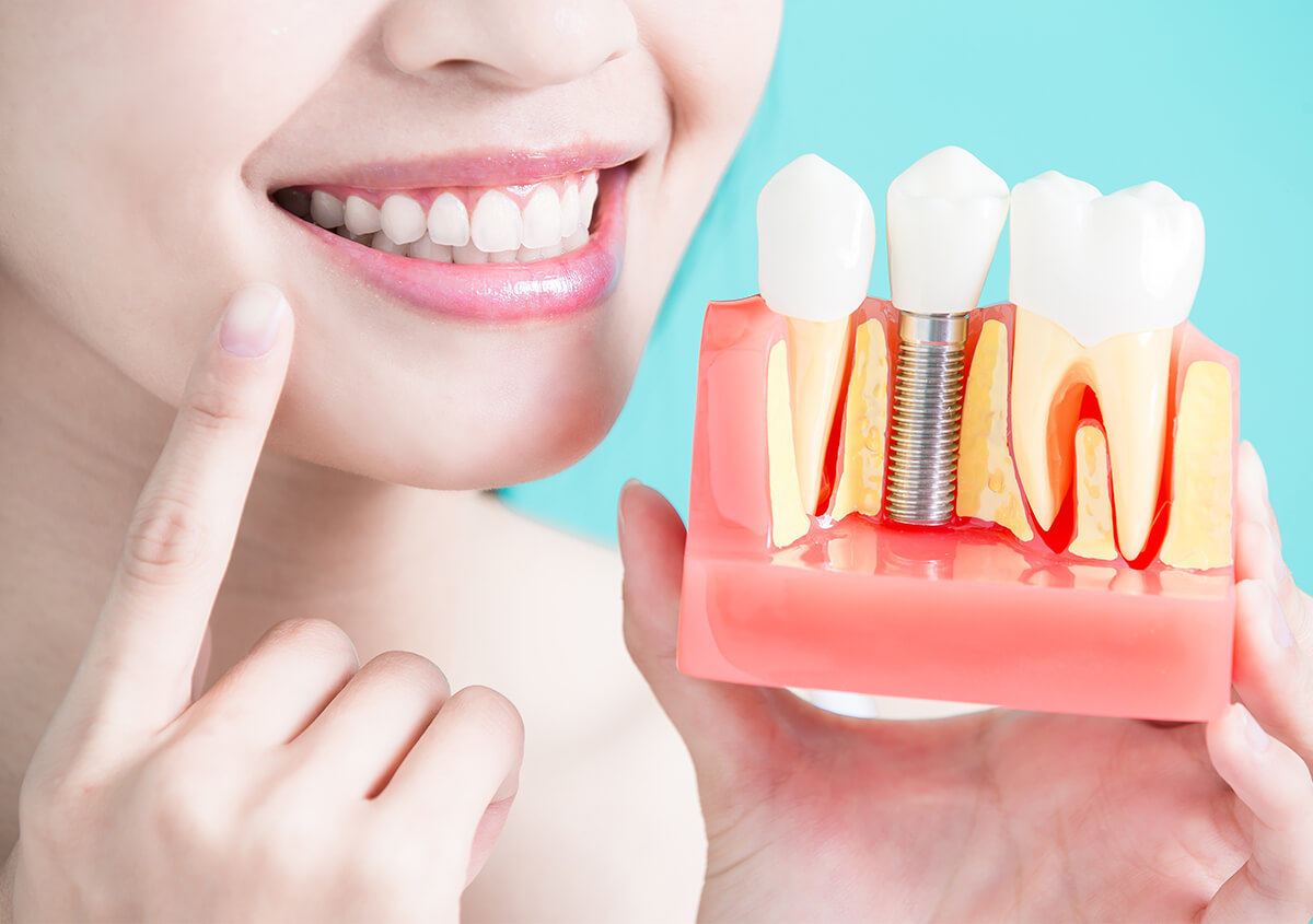 Teeth Implants Dentist in Prescott WI Area